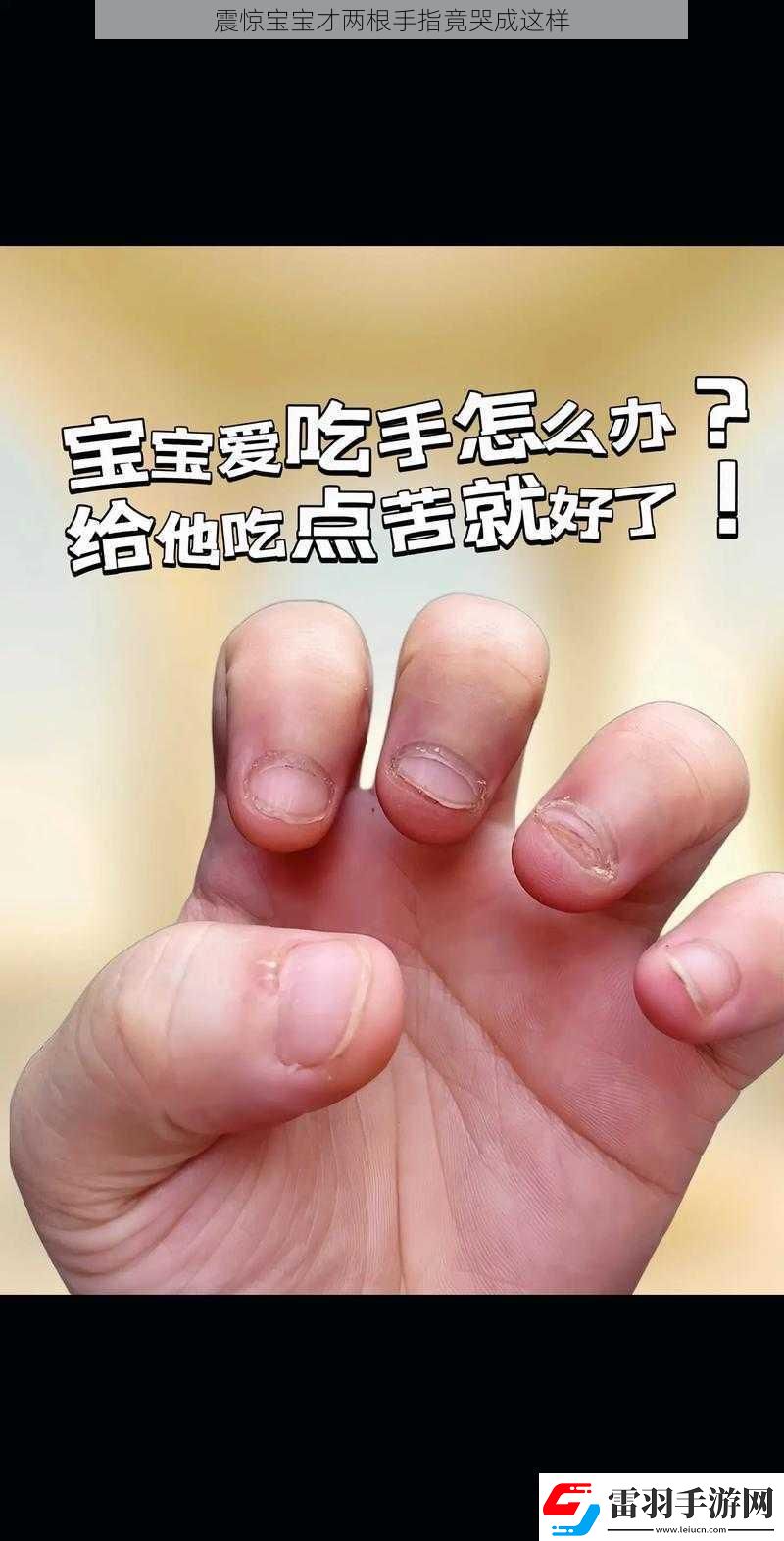震惊宝宝才两根手指竟哭成这样