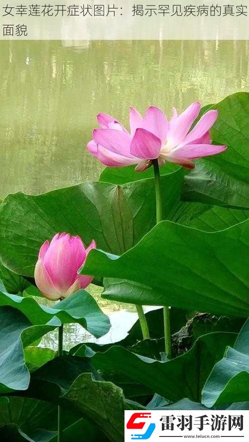 女幸莲花开症状图片