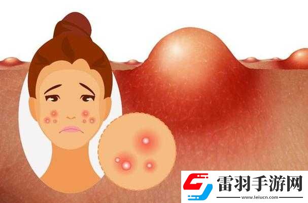 一加速女朋友就会哭原因分析之探讨