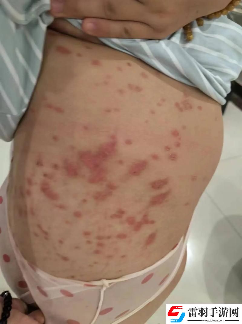 科技狂潮下的皮肤疙瘩谜团