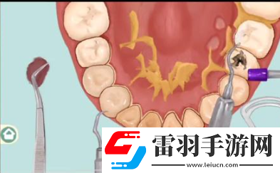 小小收纳唇红齿白怎么过关