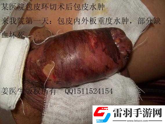 男人割皮包后为何要手举着样子