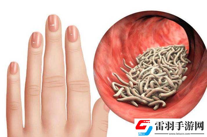 叔叔说我体内有虫子需进一步检查