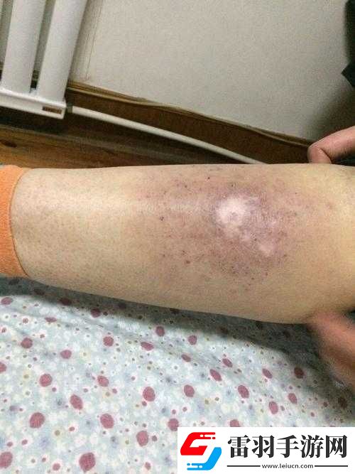 淑芬两腿中间痒得厉害且难受难耐