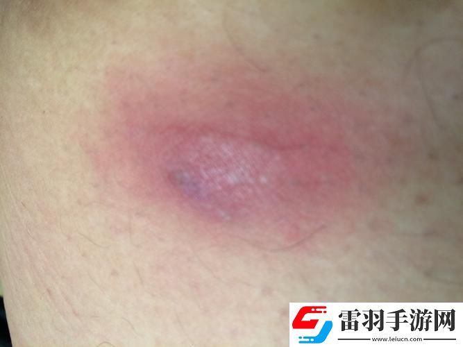 科技江湖突现「身体疙瘩侠」
