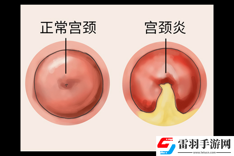 啪啪顶到最里面流血情况是否常见及相关探讨